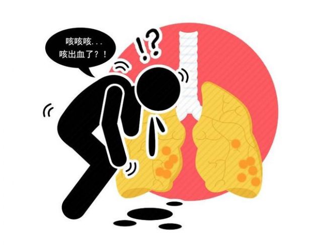 一旦有这4种异常劝你及时做个检查
