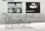 胎儿大排畸彩超单怎么看？医生教你看懂11个指标