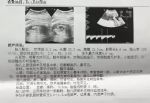 胎儿大排畸彩超单怎么看？医生教你看懂11个指标