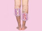 比癌症危害更大？提醒：避免血栓来袭，晚上坚持“3多3少”